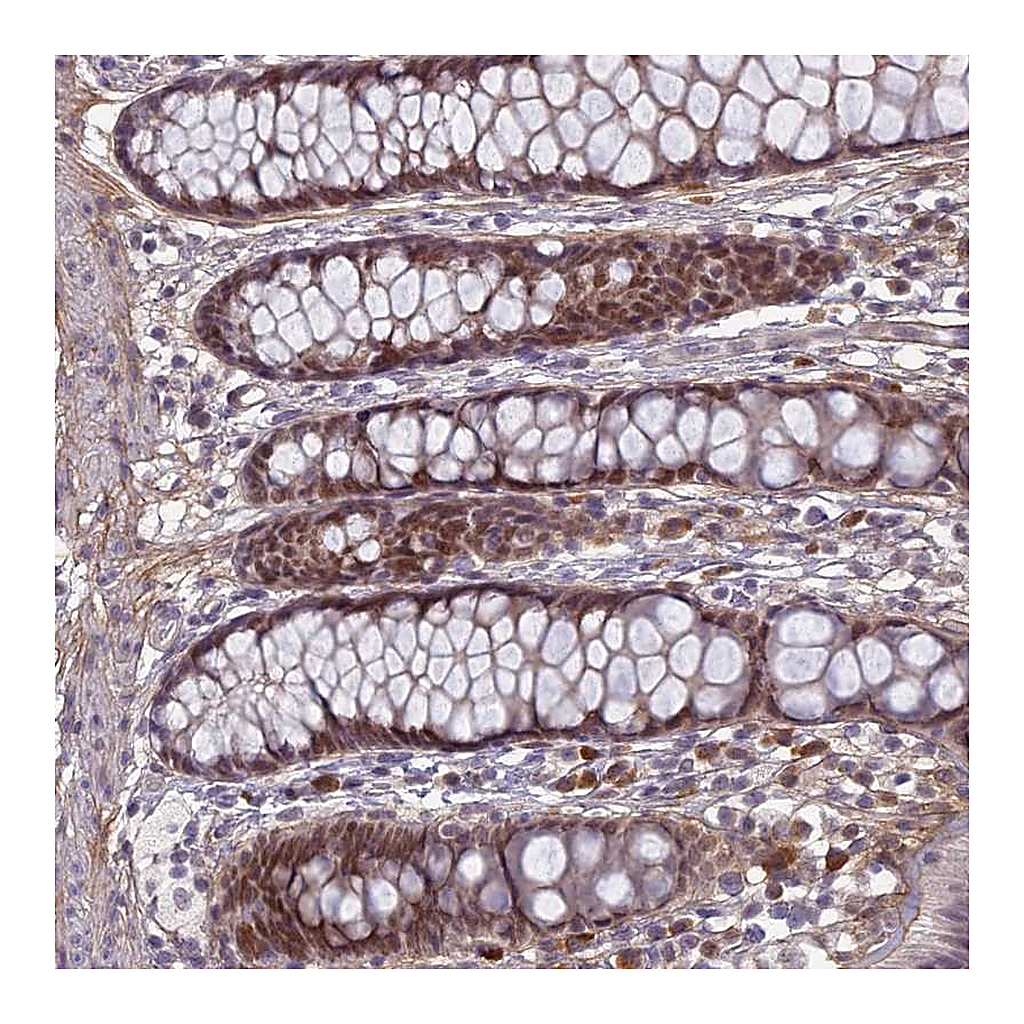 Atlas Antibodies Anti-PABPN1L Antibody