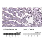 Atlas Antibodies Anti-PACRG Antibody