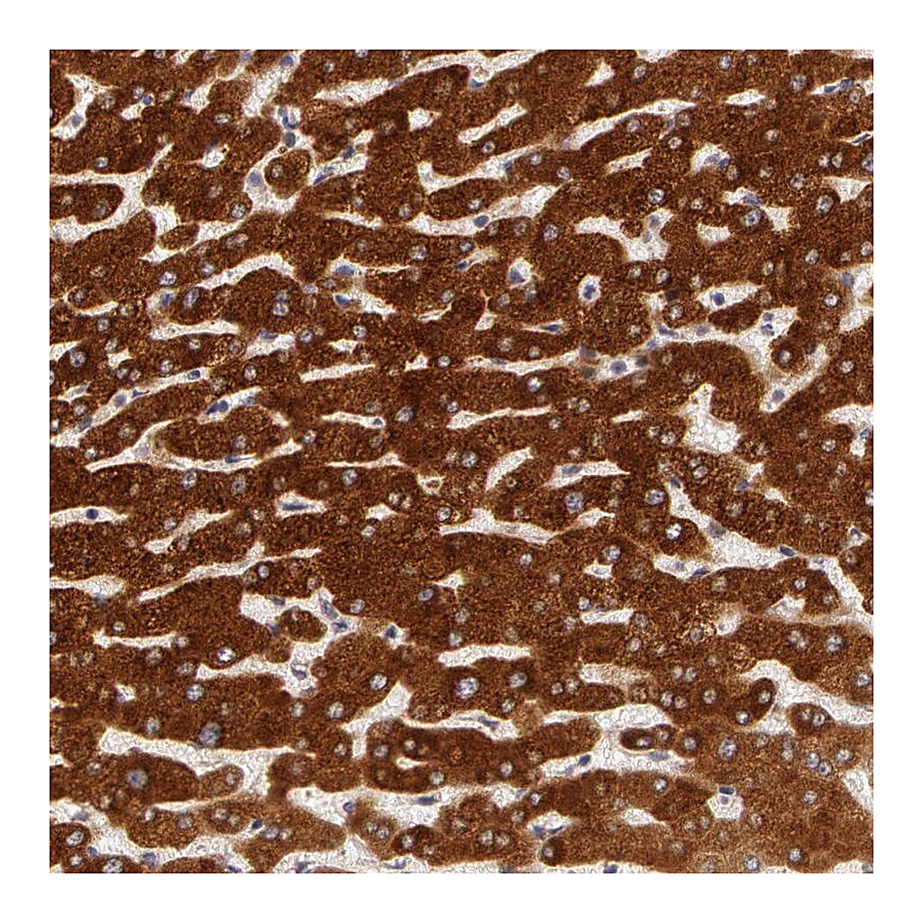 Atlas Antibodies Anti-PACS2 Antibody