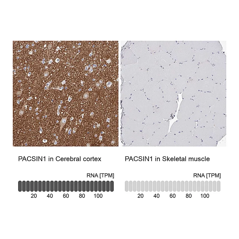Atlas Antibodies Anti-PACSIN1 Antibody
