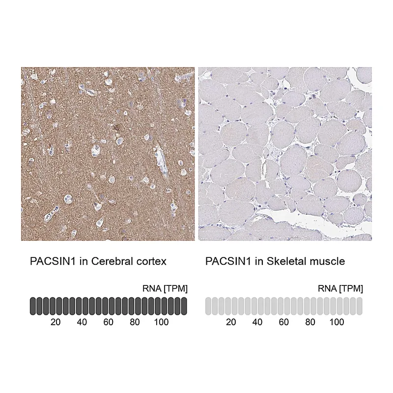 Atlas Antibodies Anti-PACSIN1 Antibody