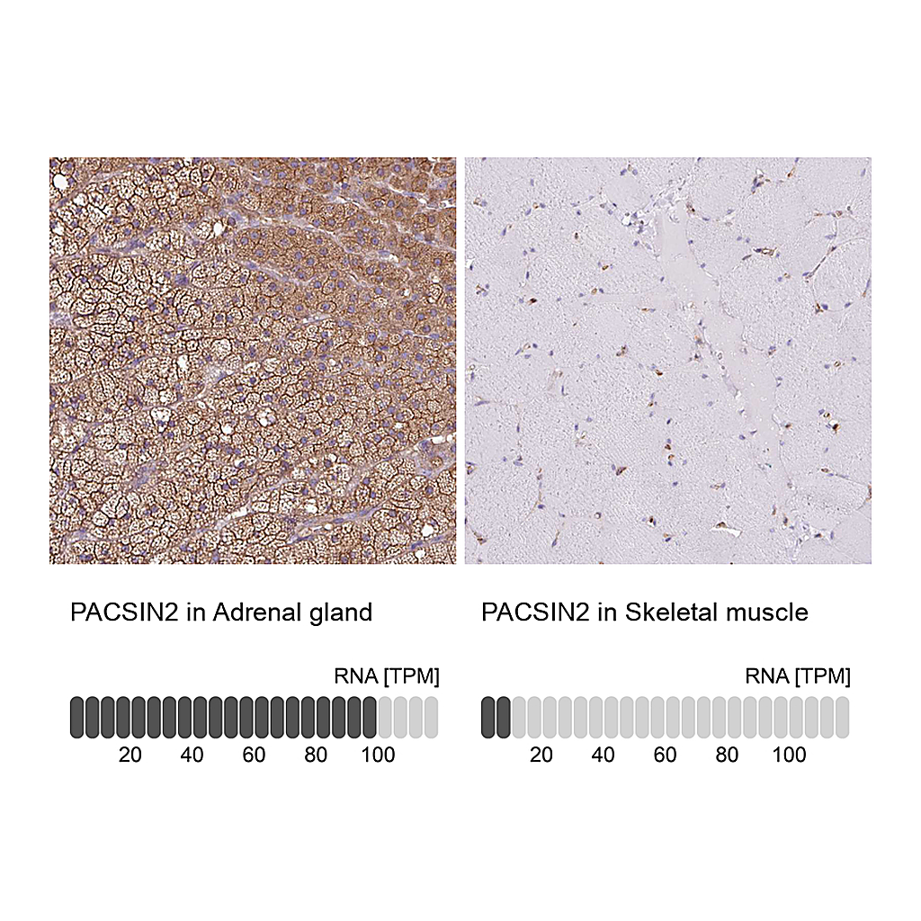 Atlas Antibodies Anti-PACSIN2 Antibody