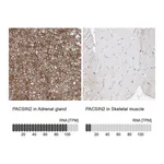 Atlas Antibodies Anti-PACSIN2 Antibody