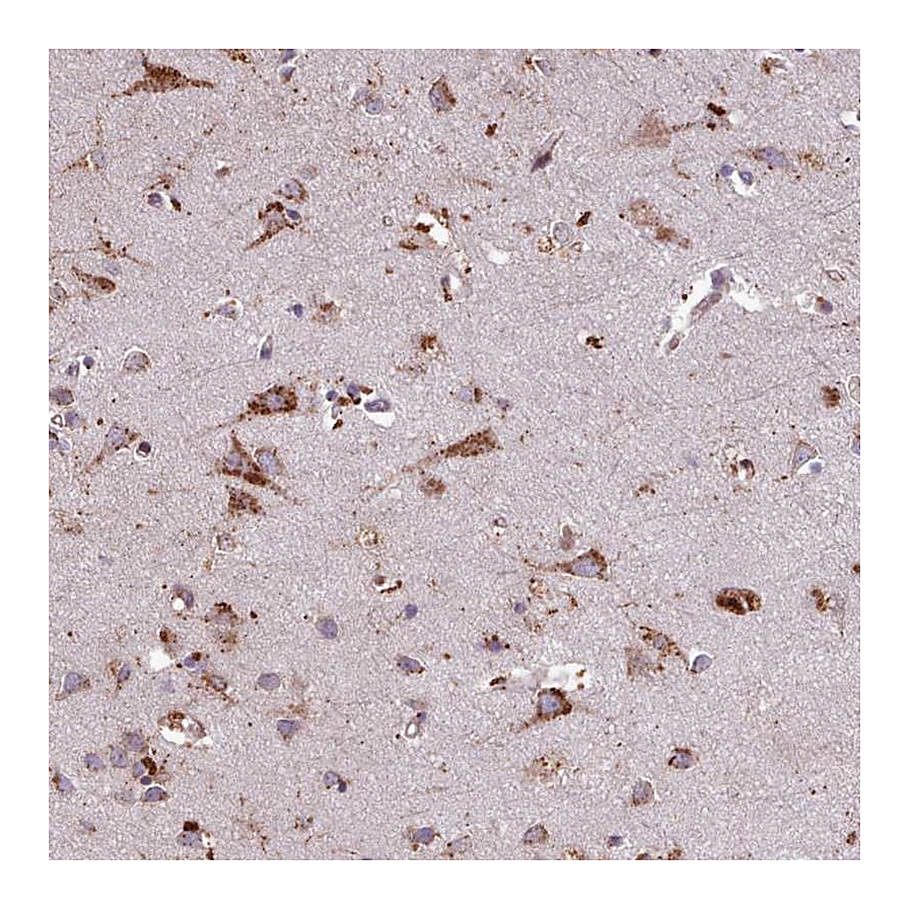 Atlas Antibodies Anti-PACSIN3 Antibody