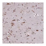 Atlas Antibodies Anti-PACSIN3 Antibody