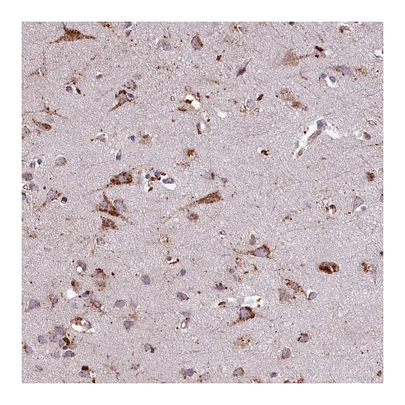 Atlas Antibodies Anti-PACSIN3 Antibody
