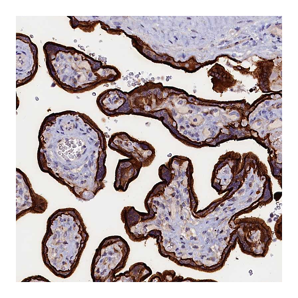 Atlas Antibodies Anti-PACSIN3 Antibody
