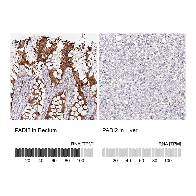 Atlas Antibodies Anti-PADI2 Antibody