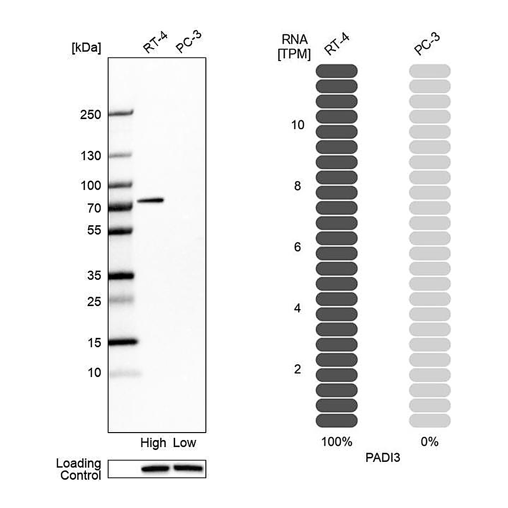 Atlas Antibodies Anti-PADI3 Antibody