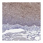 Atlas Antibodies Anti-PADI1 Antibody