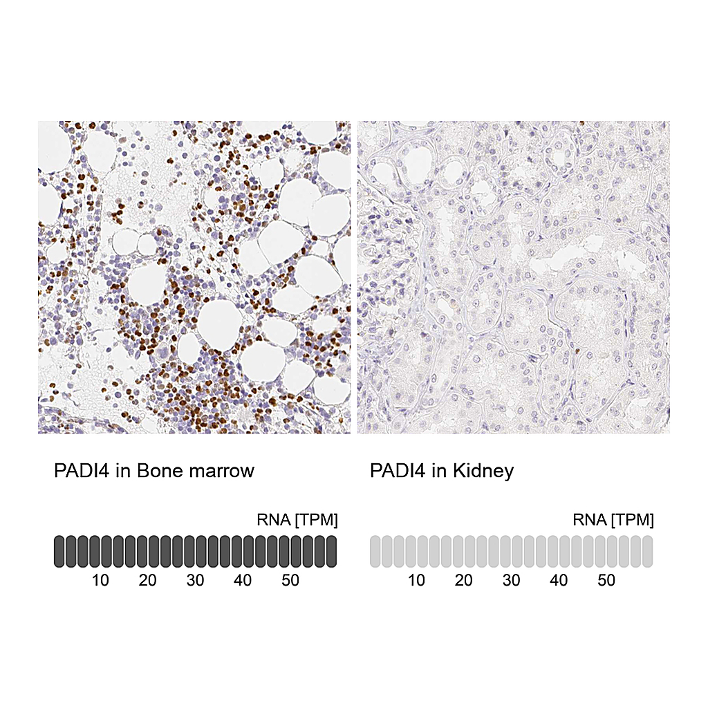 Atlas Antibodies Anti-PADI4 Antibody