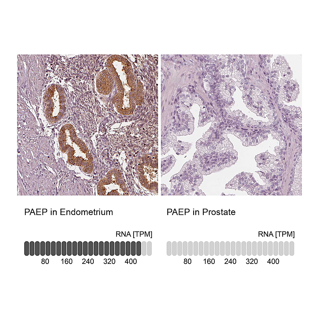 Atlas Antibodies Anti-PAEP Antibody