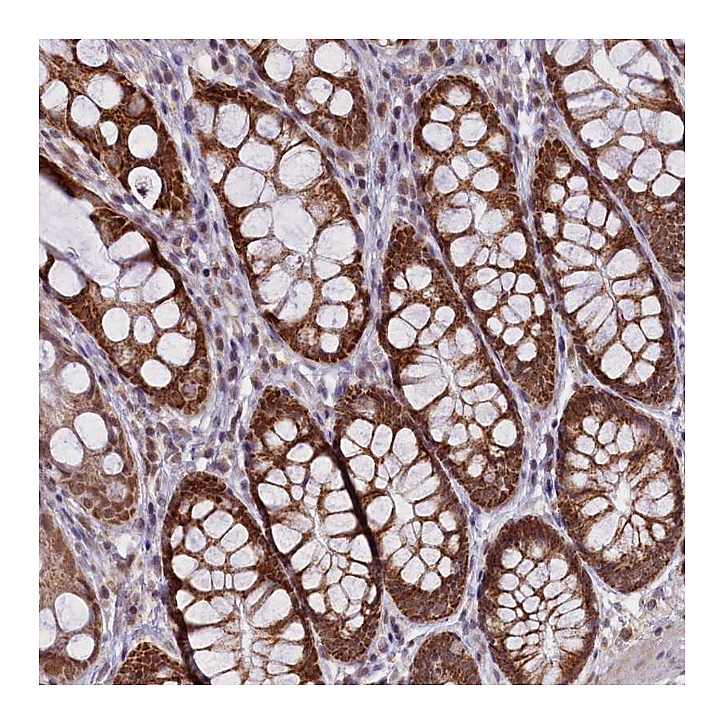Atlas Antibodies Anti-PAF1 Antibody