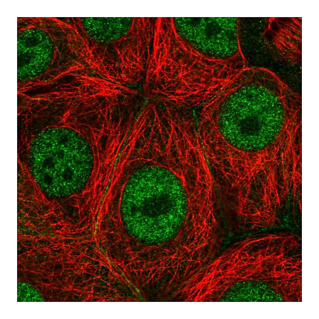 Atlas Antibodies Anti-PAF1 Antibody