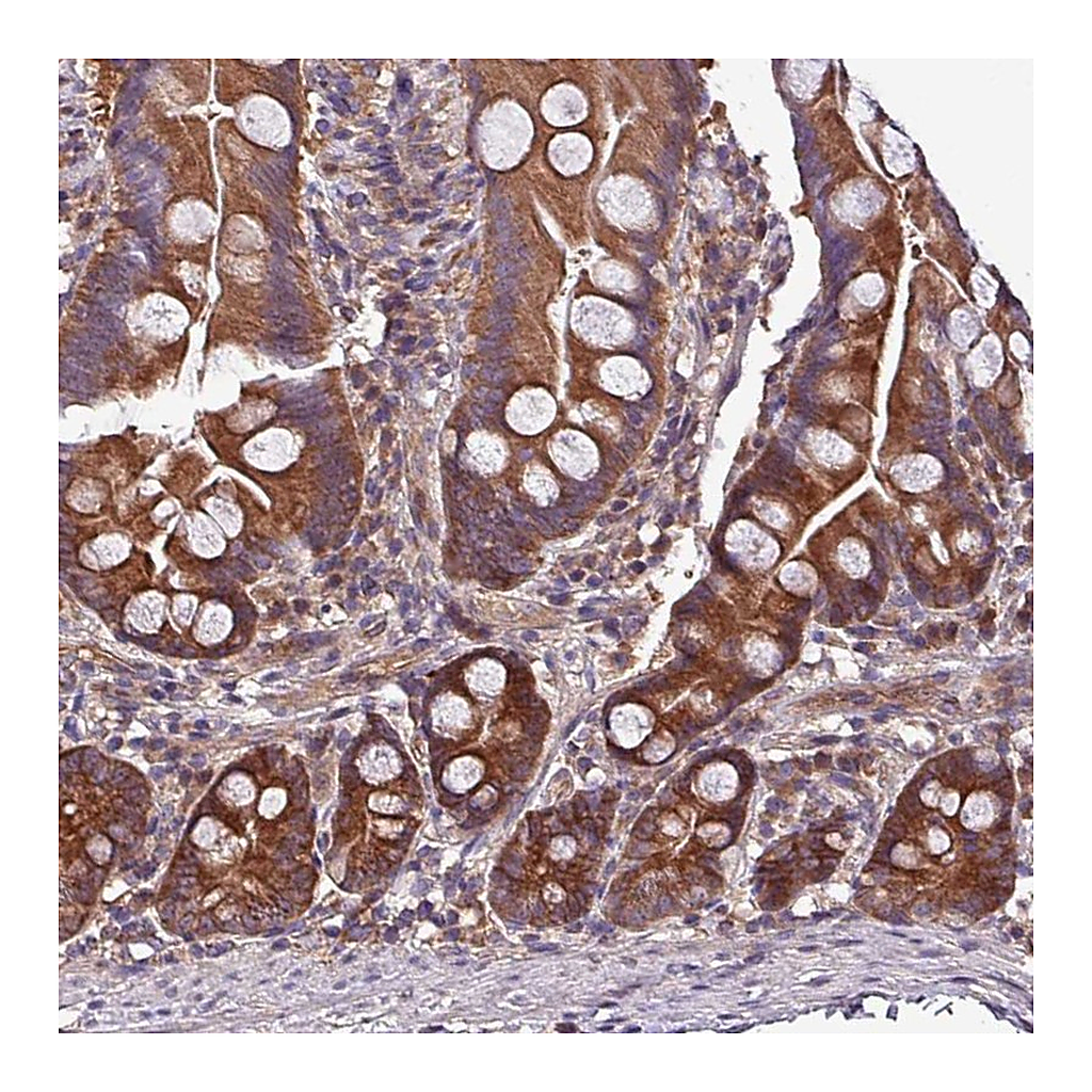 Atlas Antibodies Anti-PAFAH1B2 Antibody