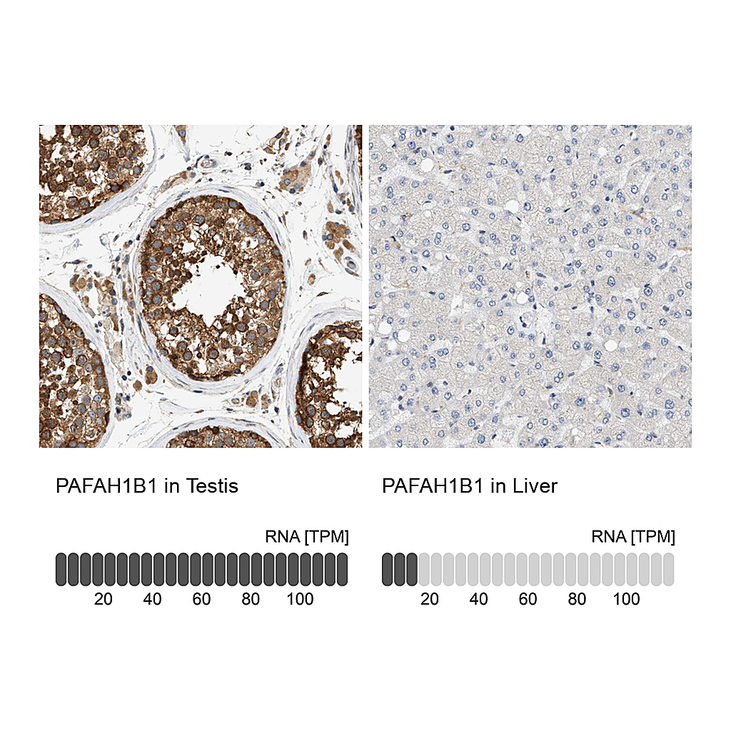 Atlas Antibodies Anti-PAFAH1B1 Antibody