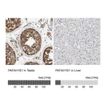 Atlas Antibodies Anti-PAFAH1B1 Antibody