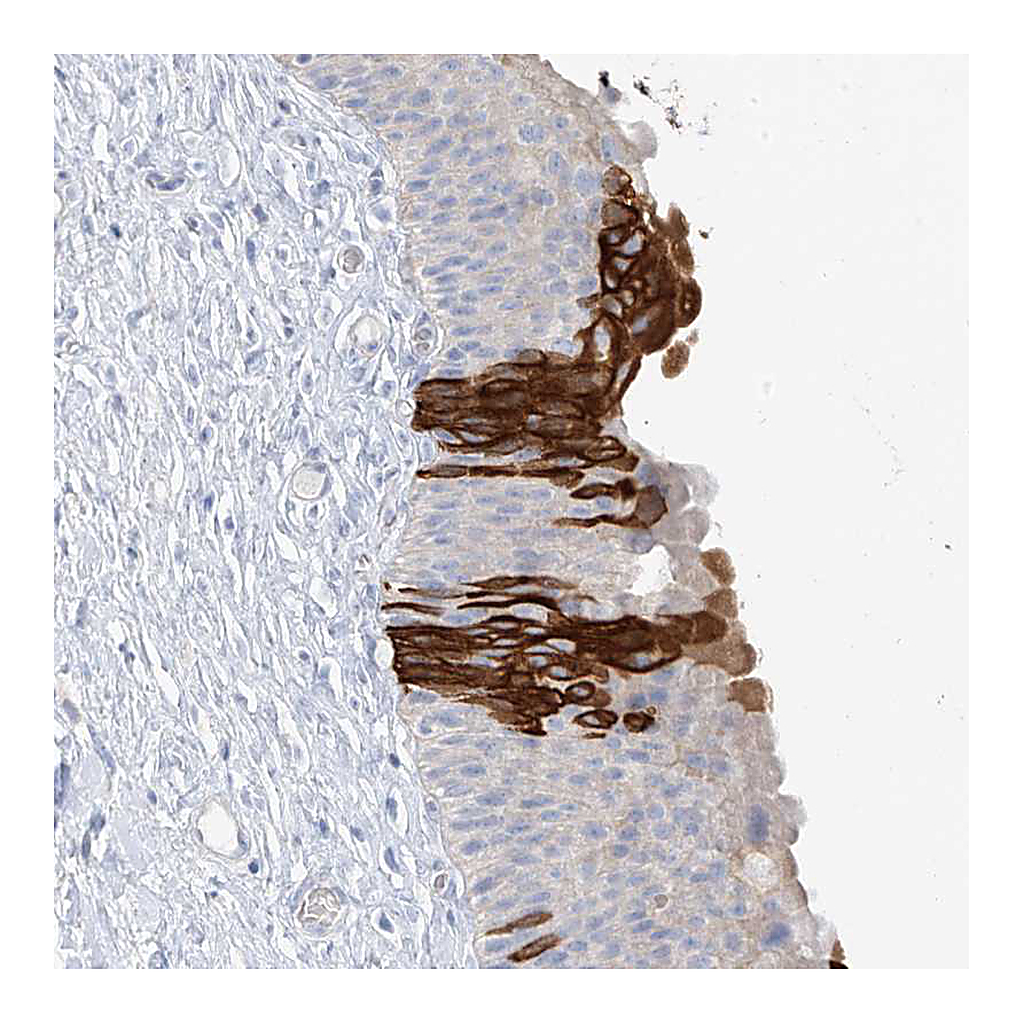 Atlas Antibodies Anti-PAFAH1B3 Antibody