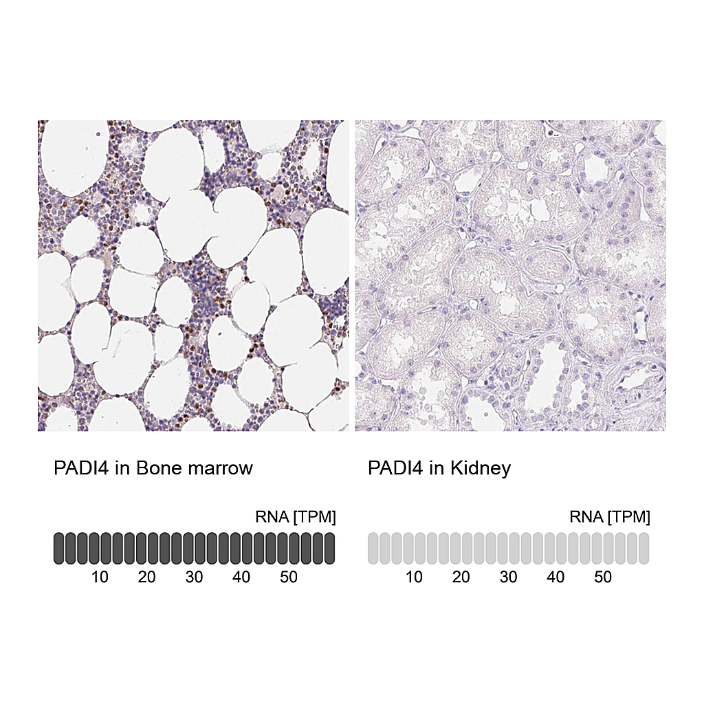 Atlas Antibodies Anti-PADI4 Antibody
