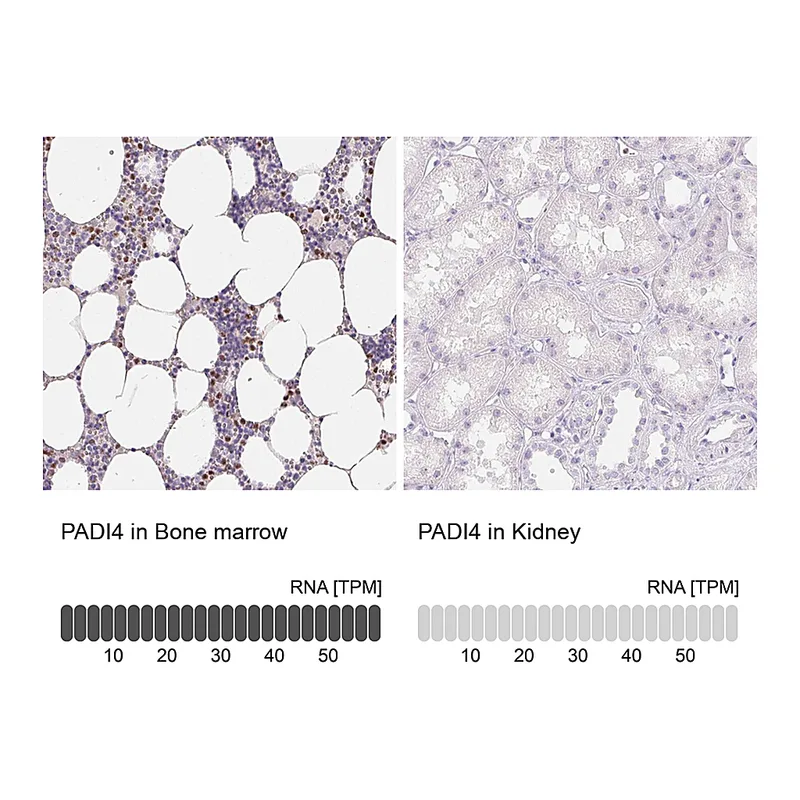 Atlas Antibodies Anti-PADI4 Antibody