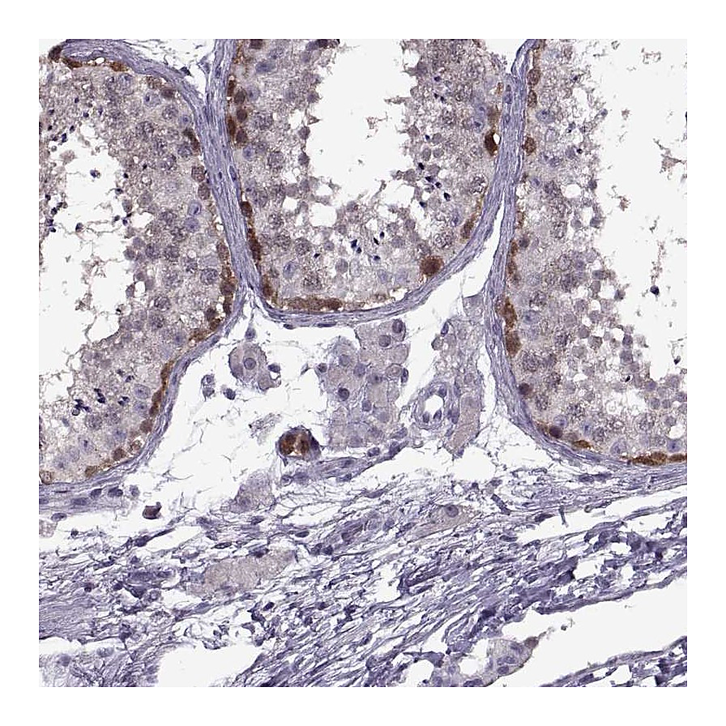 Atlas Antibodies Anti-PAGE2B Antibody
