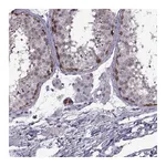 Atlas Antibodies Anti-PAGE2B Antibody