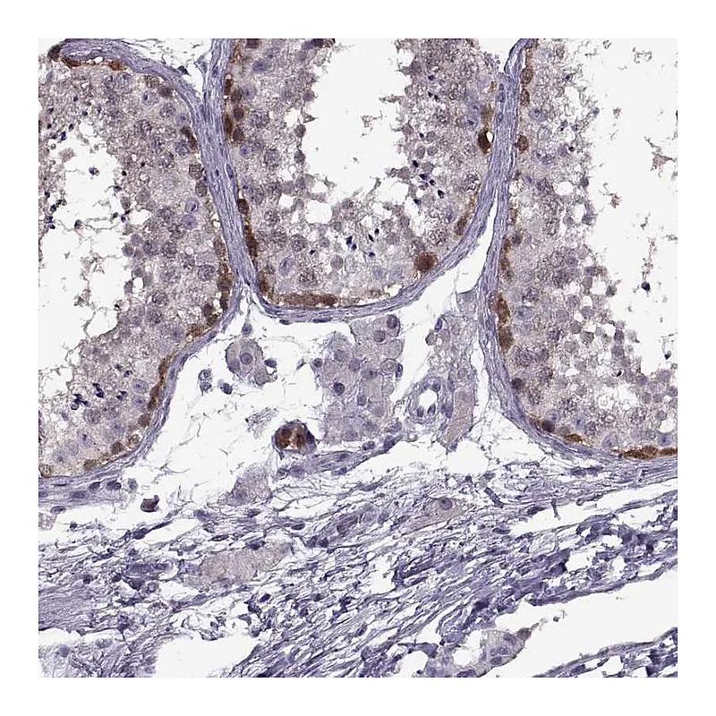 Atlas Antibodies Anti-PAGE2B Antibody