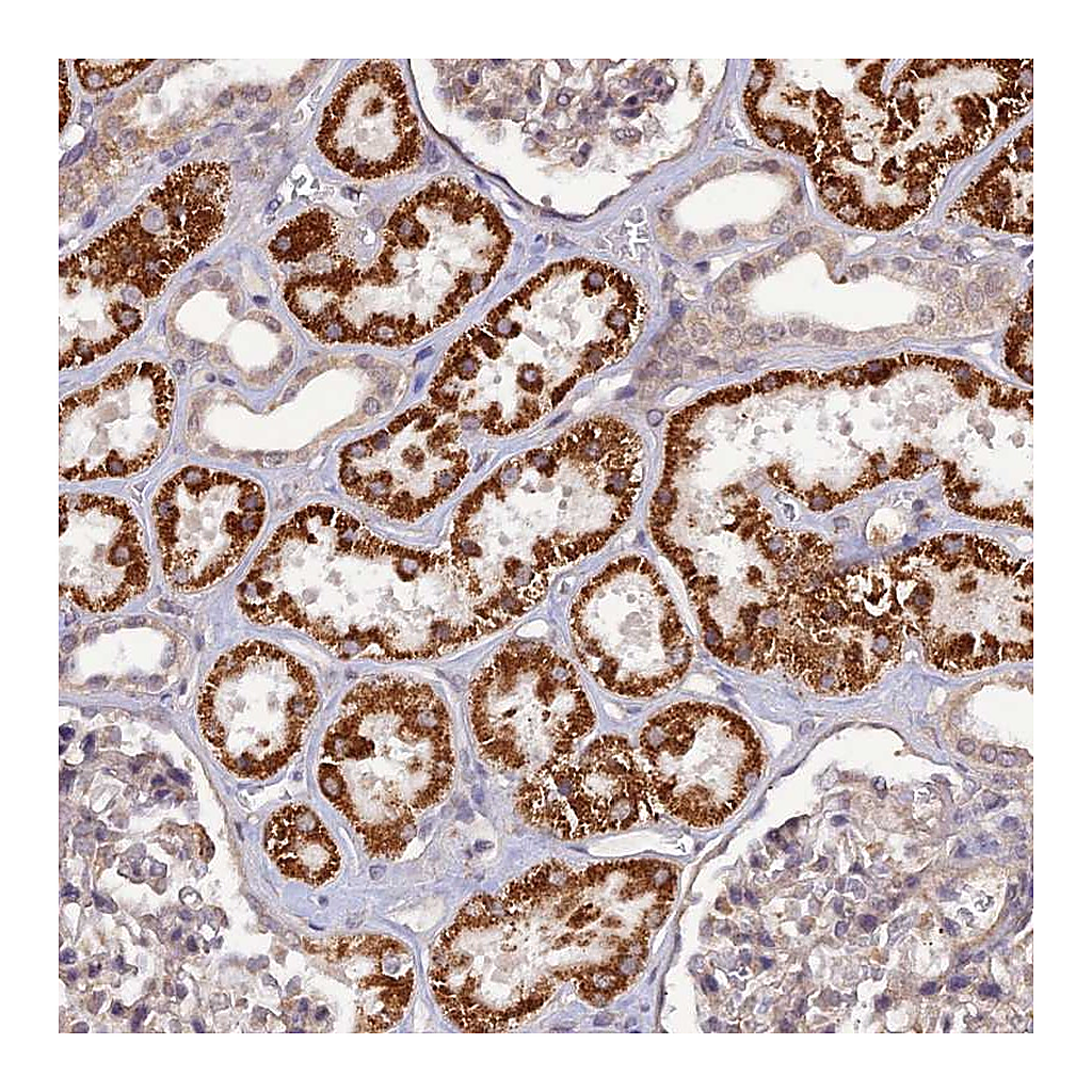 Atlas Antibodies Anti-PAGR1 Antibody