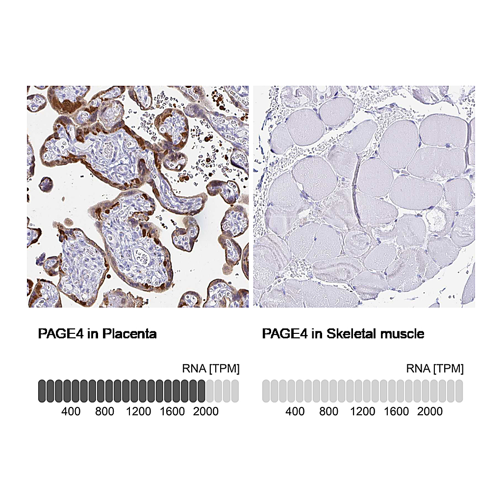 Atlas Antibodies Anti-PAGE4 Antibody