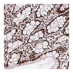 Atlas Antibodies Anti-PAGE3 Antibody