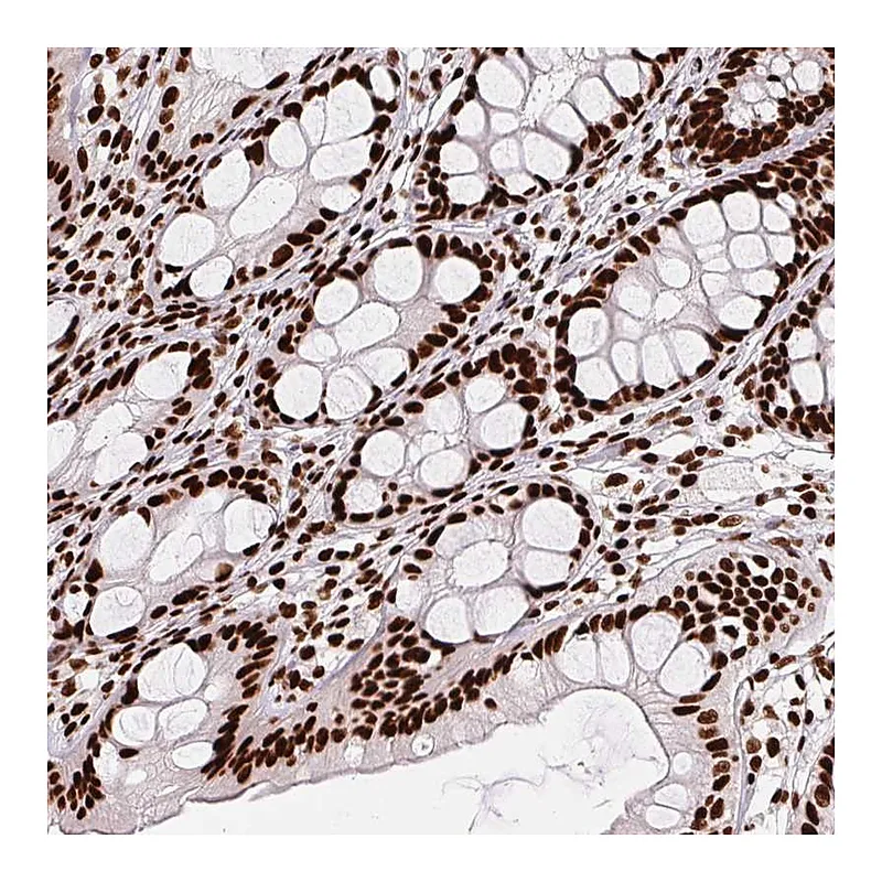 Atlas Antibodies Anti-PAGE3 Antibody