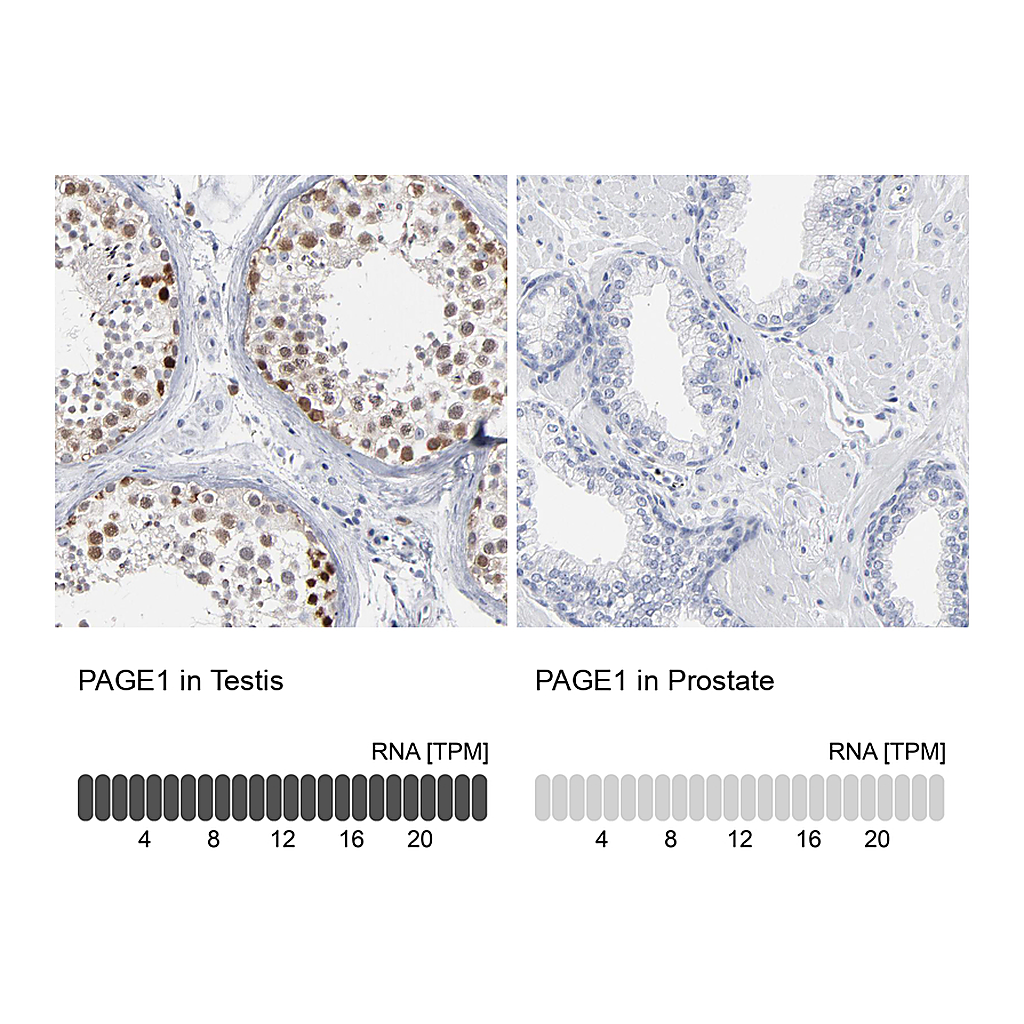 Atlas Antibodies Anti-PAGE1 Antibody