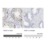 Atlas Antibodies Anti-PAGE1 Antibody
