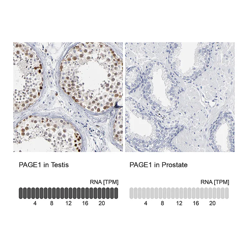 Atlas Antibodies Anti-PAGE1 Antibody