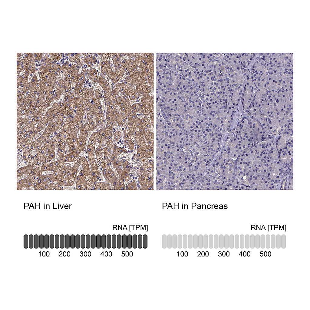 Atlas Antibodies Anti-PAH Antibody