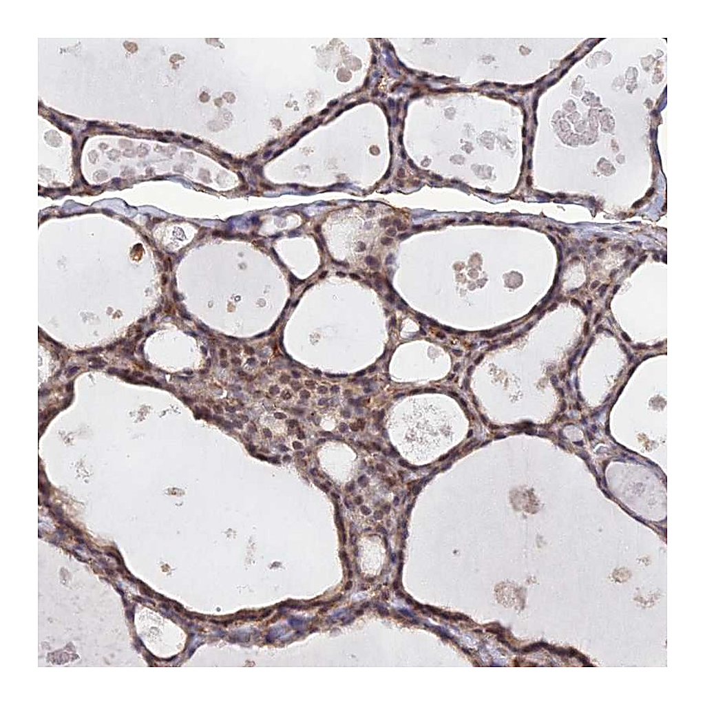 Atlas Antibodies Anti-PAGR1 Antibody