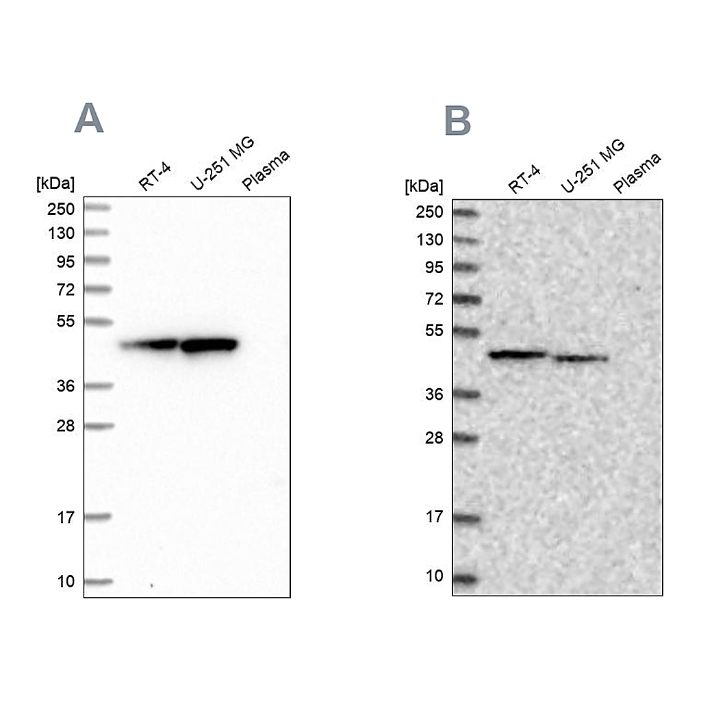 Atlas Antibodies Anti-PAICS Antibody