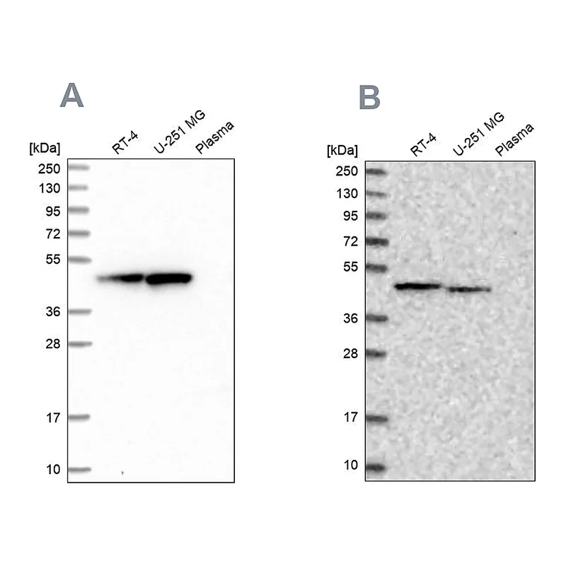 Atlas Antibodies Anti-PAICS Antibody