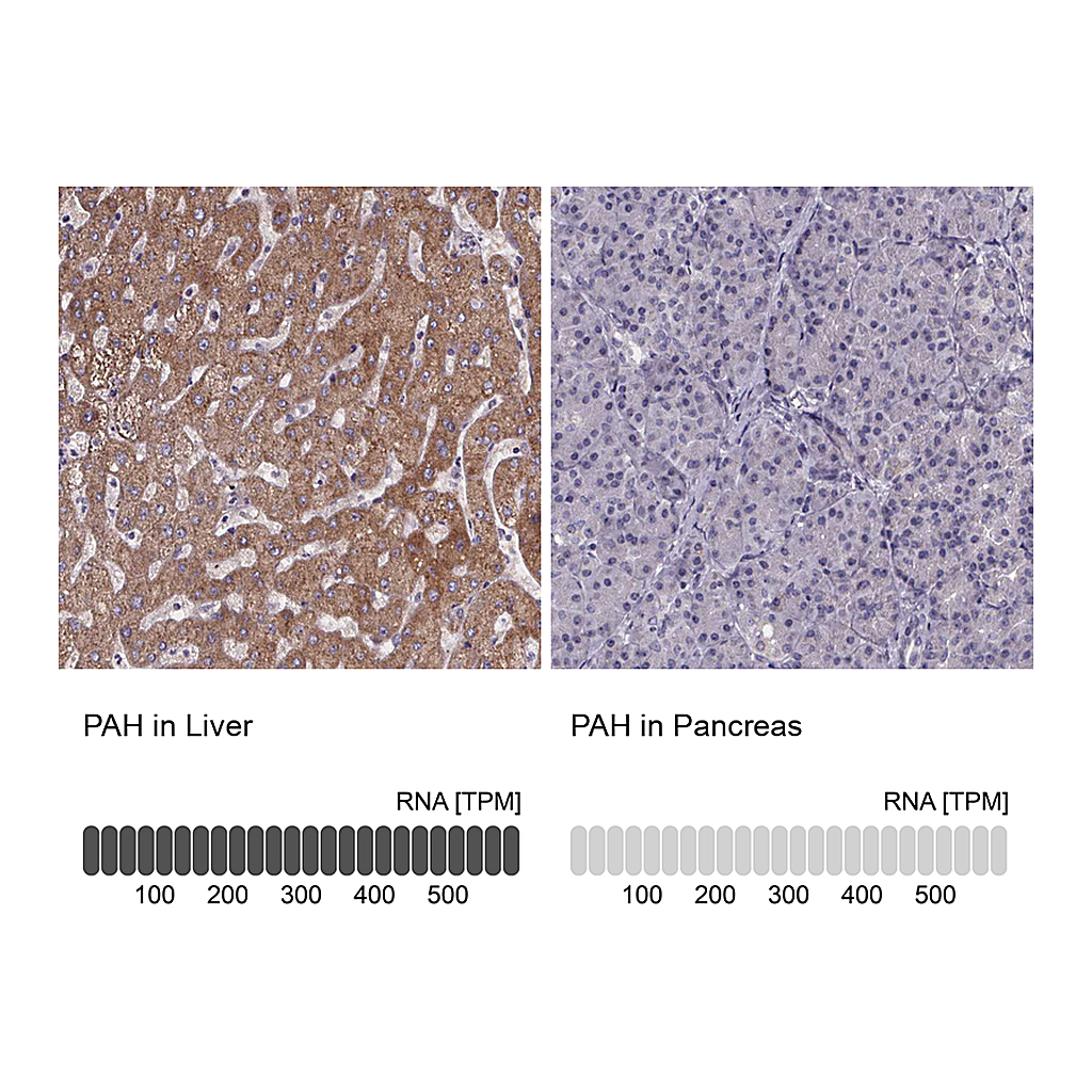 Atlas Antibodies Anti-PAH Antibody
