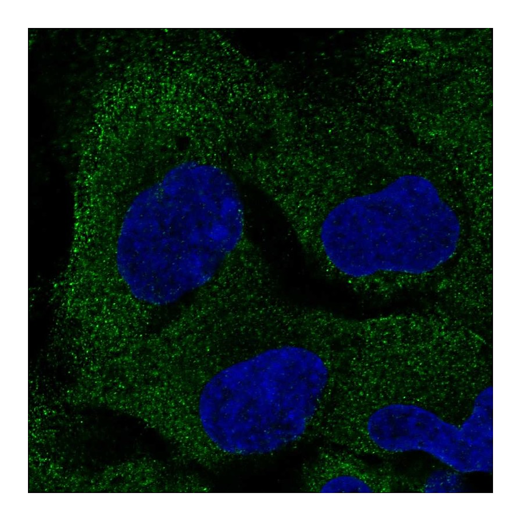 Atlas Antibodies Anti-PAIP2B Antibody