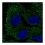 Atlas Antibodies Anti-PAIP2B Antibody