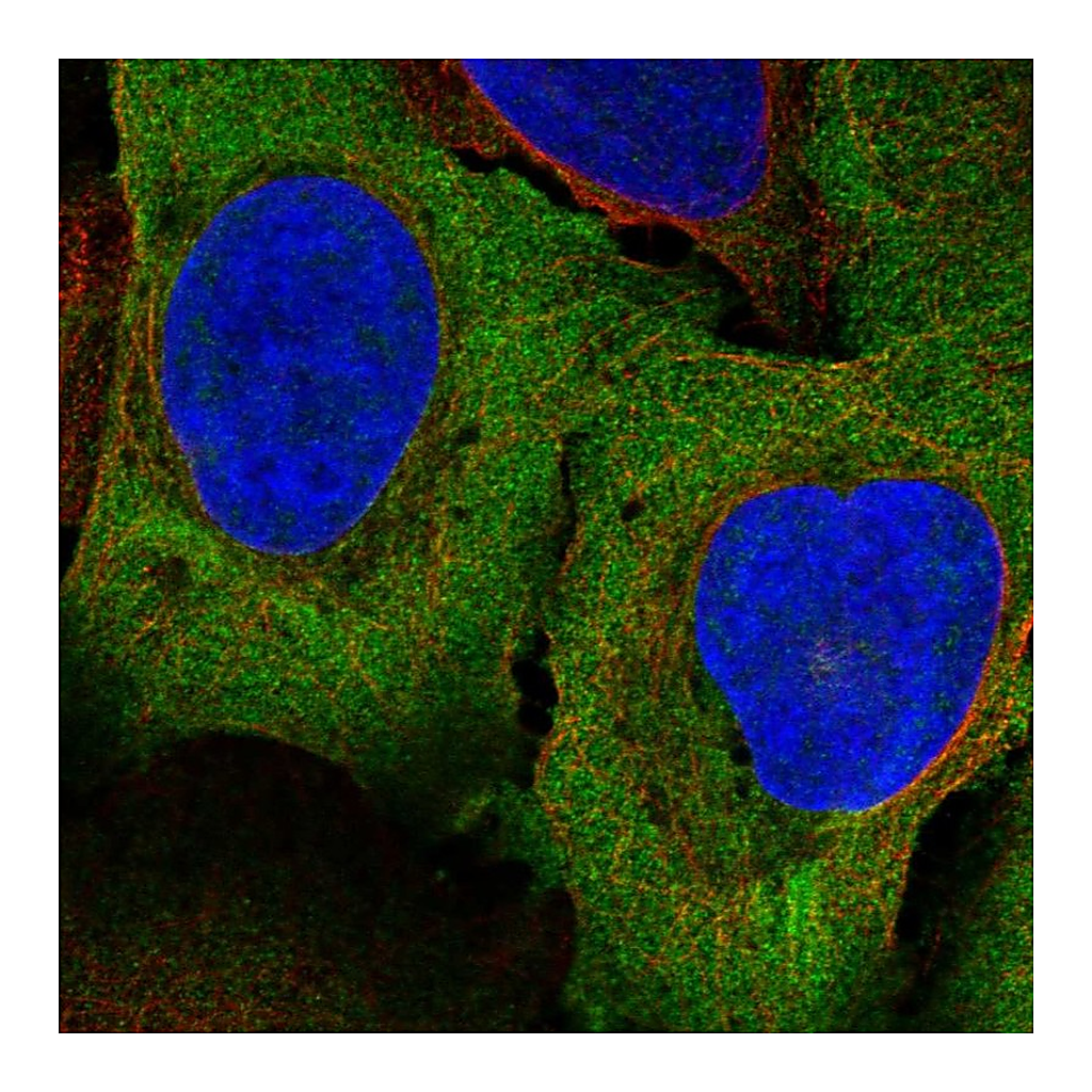 Atlas Antibodies Anti-PAIP1 Antibody