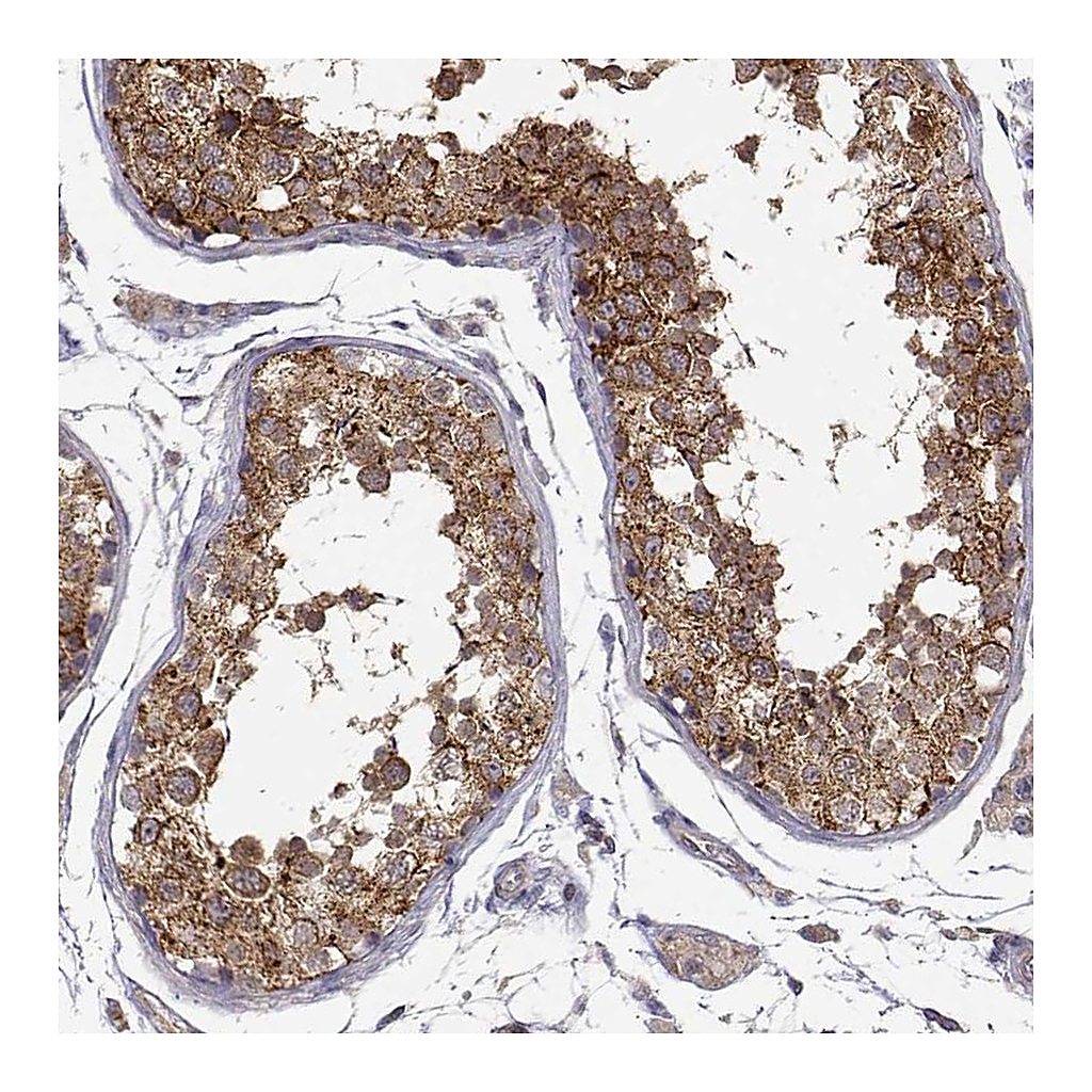 Atlas Antibodies Anti-PAIP1 Antibody