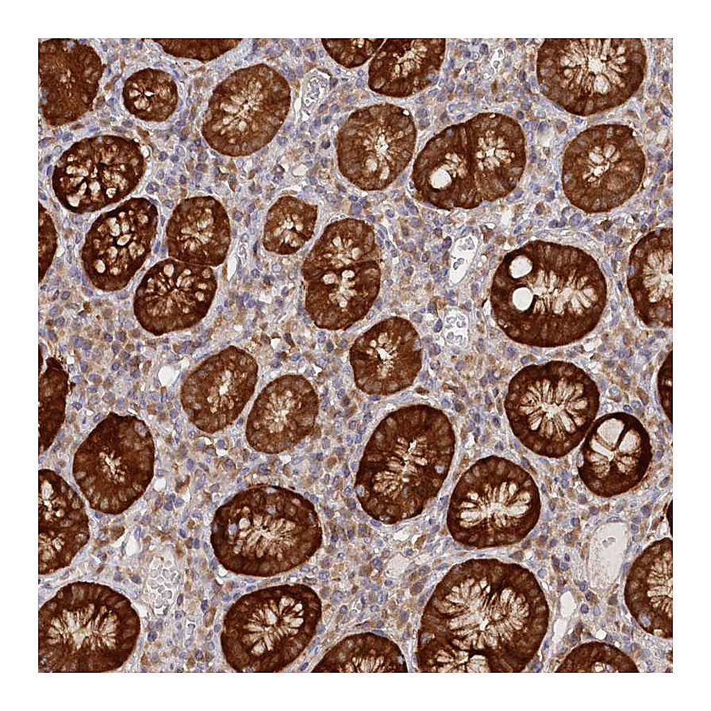 Atlas Antibodies Anti-PAIP2 Antibody