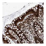 Atlas Antibodies Anti-PAK1IP1 Antibody