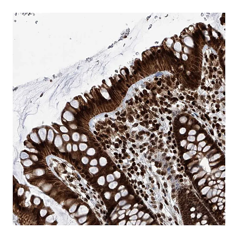 Atlas Antibodies Anti-PAK1IP1 Antibody