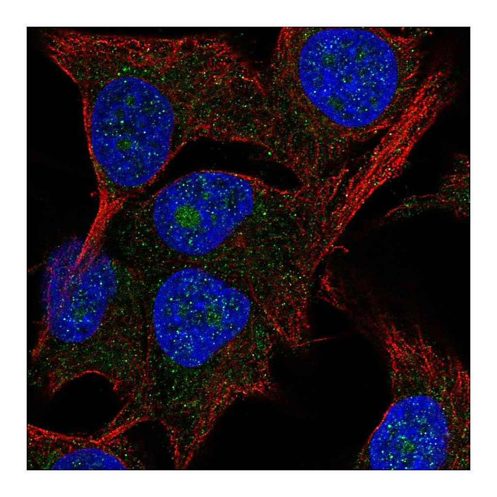 Atlas Antibodies Anti-PAK1IP1 Antibody