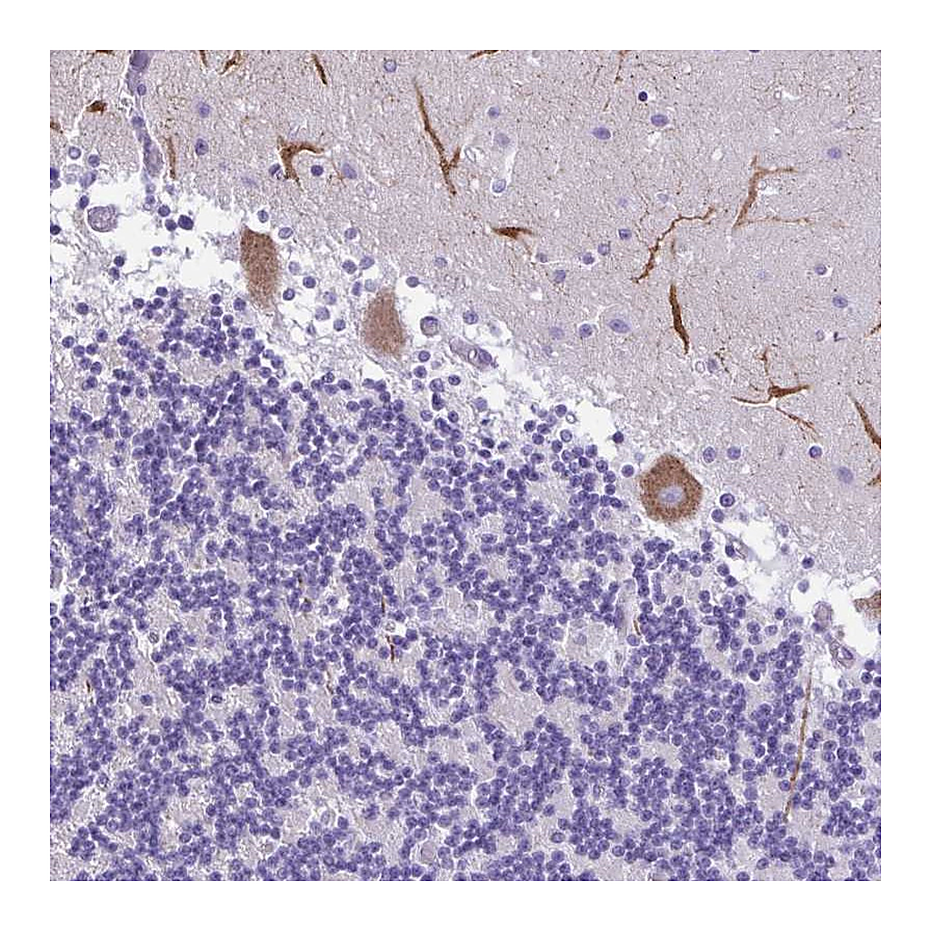 Atlas Antibodies Anti-PAK3 Antibody