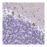 Atlas Antibodies Anti-PAK3 Antibody