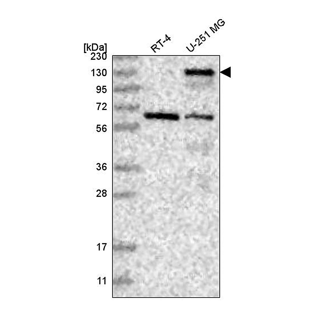 Atlas Antibodies Anti-PALLD Antibody